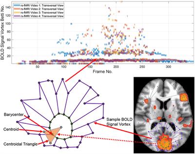 Topological View of Flows Inside the BOLD Spontaneous Activity of the Human Brain